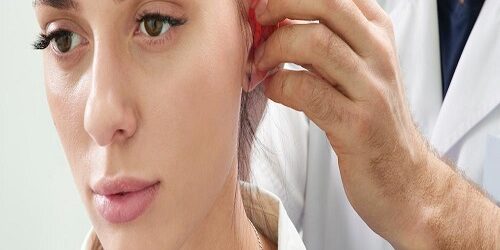 Otoplasti Ameliyatı