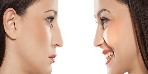 Rinoplasti Ameliyatı Kaç TL