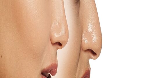 Endoskopik Sinüs Cerrahisi Ne Kadar Sürer? Endoskopik Sinüs Cerrahisi Ne Kadar Sürer?