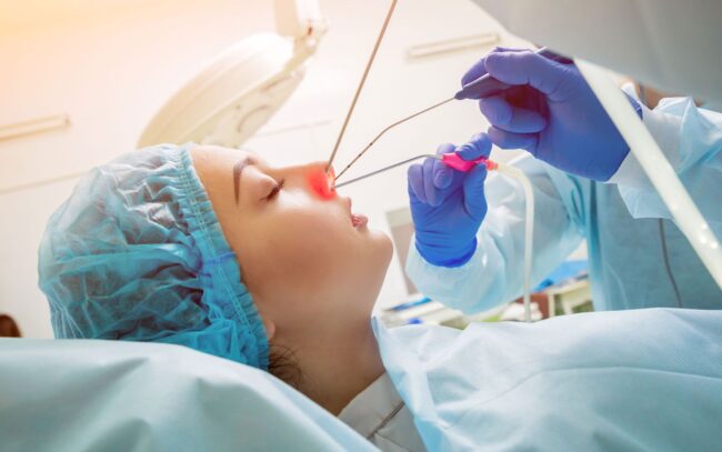 Endoskopische Nasennebenhöhlenchirurgie