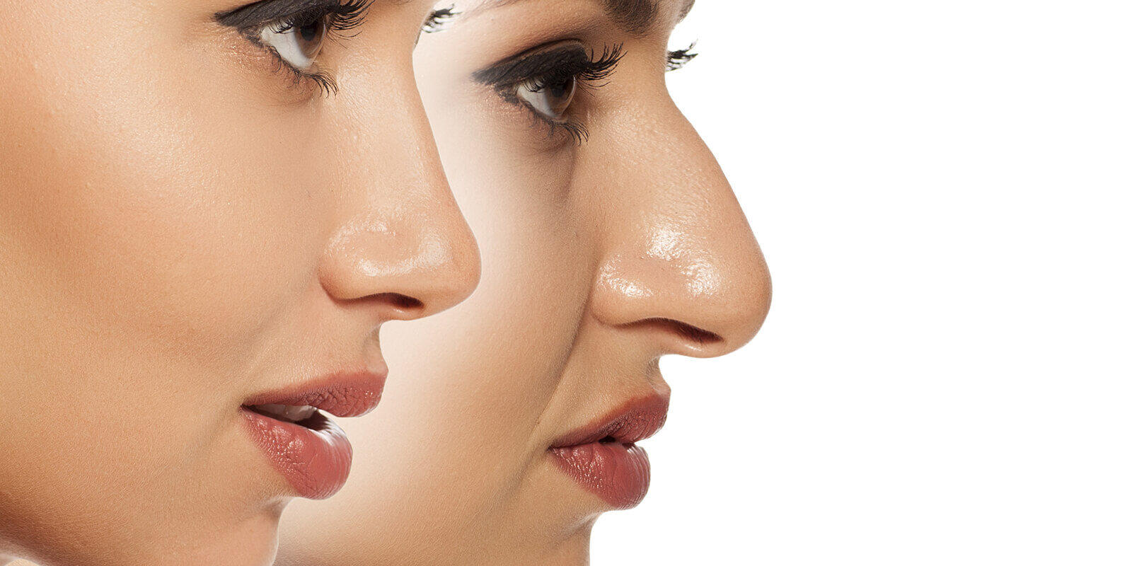 Precision Rhinoplasty