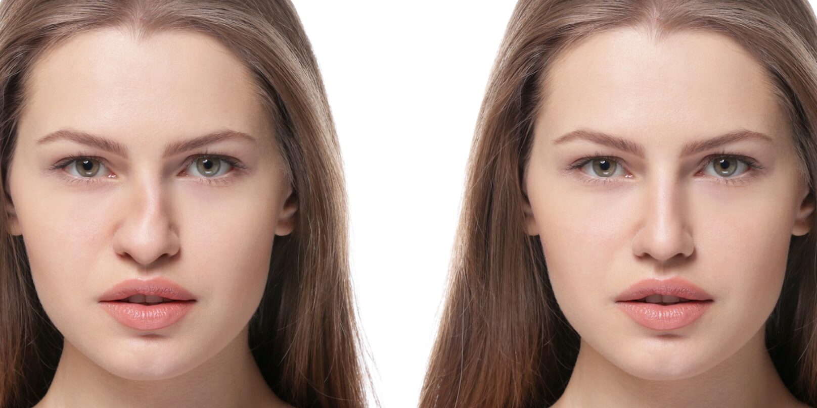 Revisions-Nasenkorrektur