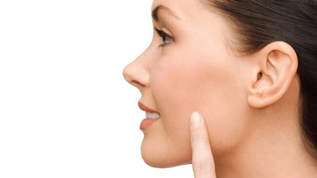 Cheek Thinning Bishectomy